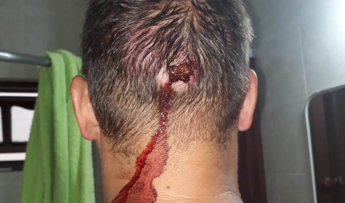 La Asociación de Prensa de la Provincia se solidarizó con el periodista brutalmente agredido