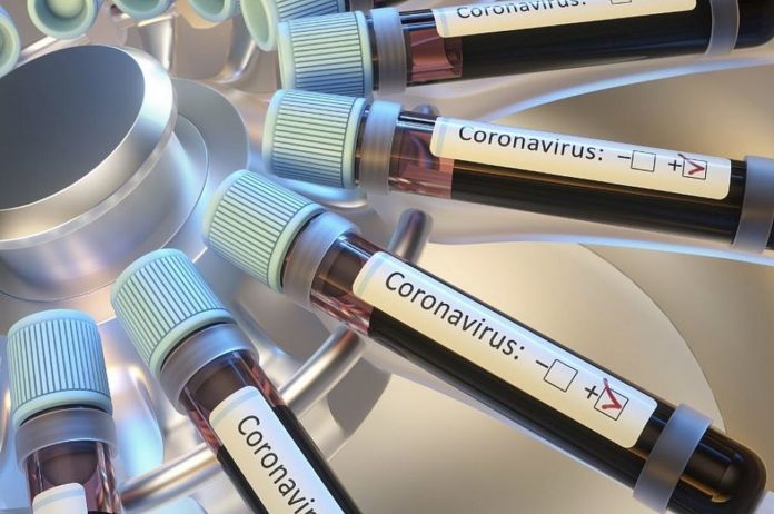 Coronavirus en Argentina: confirman 1.141 casos en las últimas 24 horas