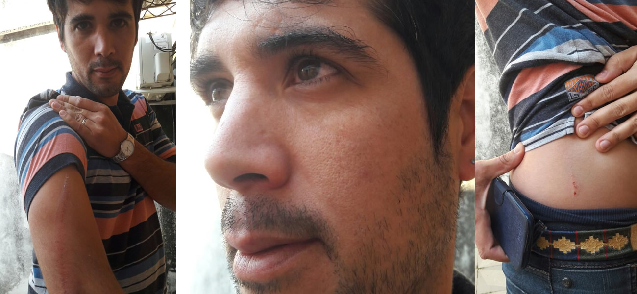 Finalmente Darán denunció a Cernadas por la agresión