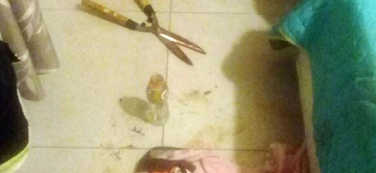 Córdoba: una mujer le cortó el pene a su amante con una tijera de podar