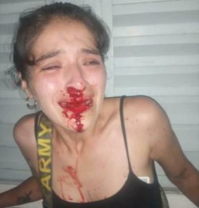 Malena Coronel luego de la agresión de Franco Ávila (Imagen viralizada por su mamá).